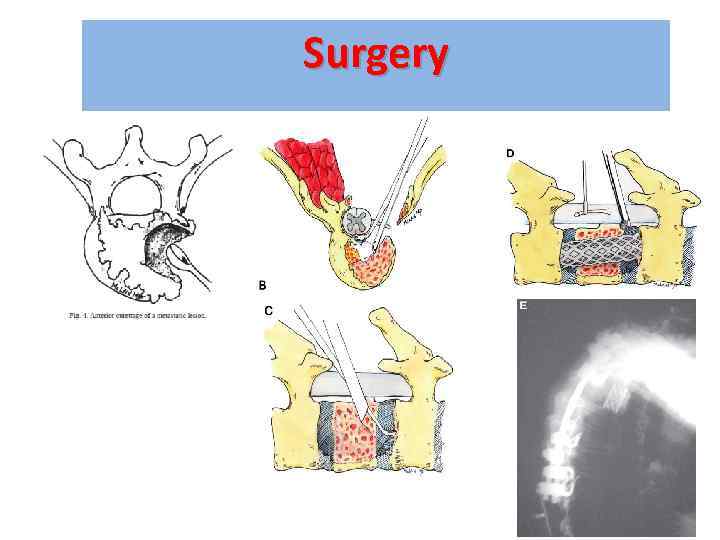 Surgery 