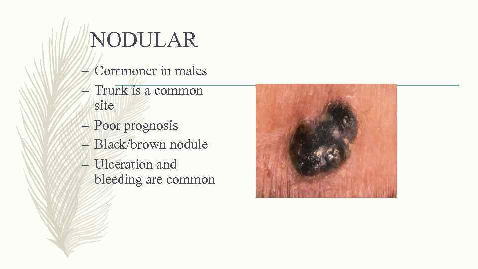 NODULAR – Commoner in males – Trunk is a common site – Poor prognosis
