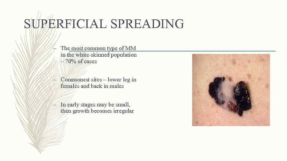 SUPERFICIAL SPREADING – The most common type of MM in the white-skinned population –