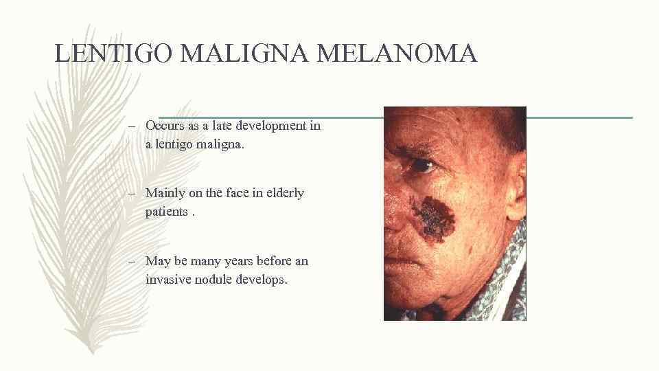 LENTIGO MALIGNA MELANOMA – Occurs as a late development in a lentigo maligna. –