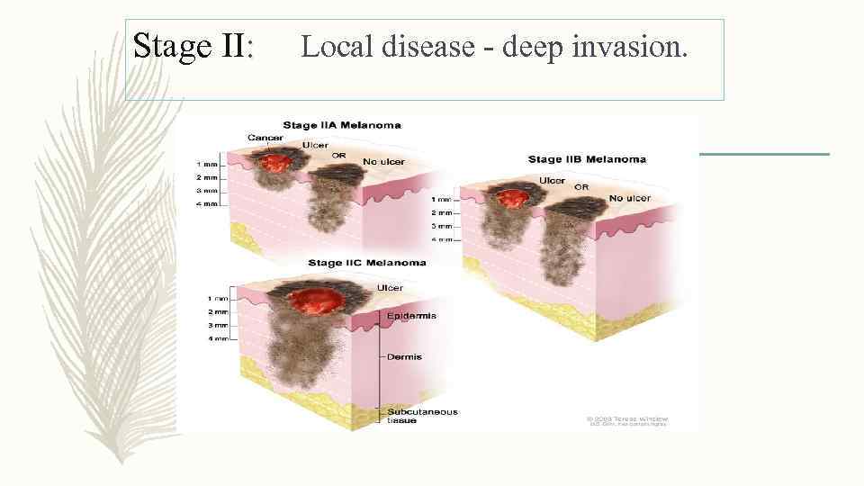 Stage II: Local disease - deep invasion. 