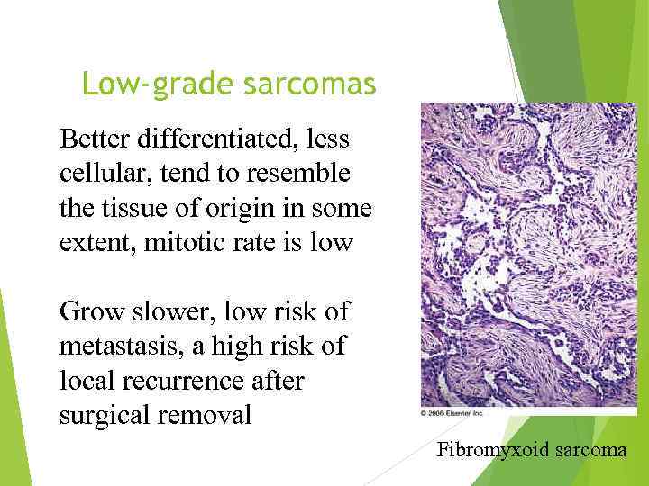 Low-grade sarcomas Better differentiated, less cellular, tend to resemble the tissue of origin in