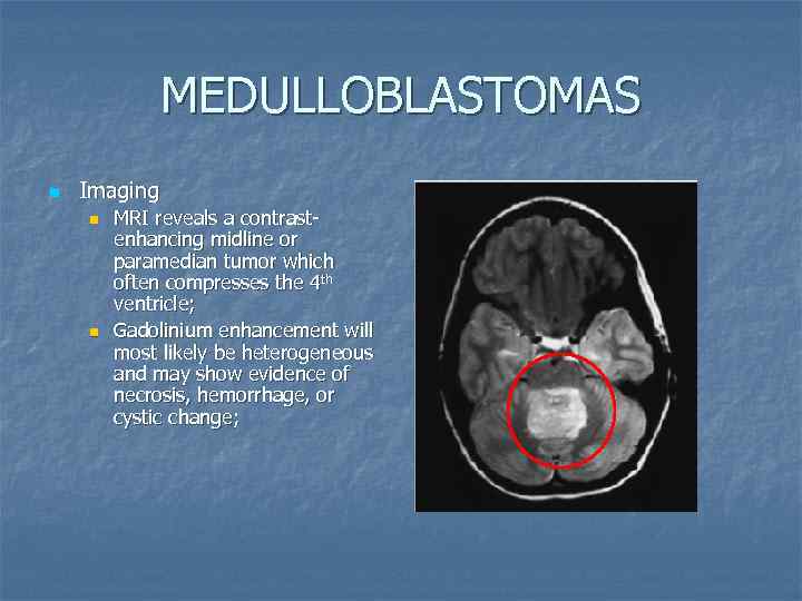 MEDULLOBLASTOMAS n Imaging n n MRI reveals a contrastenhancing midline or paramedian tumor which