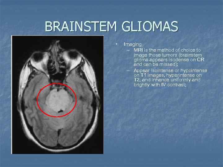 BRAINSTEM GLIOMAS • Imaging – MRI is the method of choice to image those
