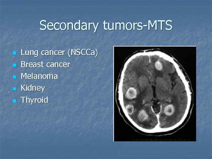 Secondary tumors-MTS n n n Lung cancer (NSCCa) Breast cancer Melanoma Kidney Thyroid 