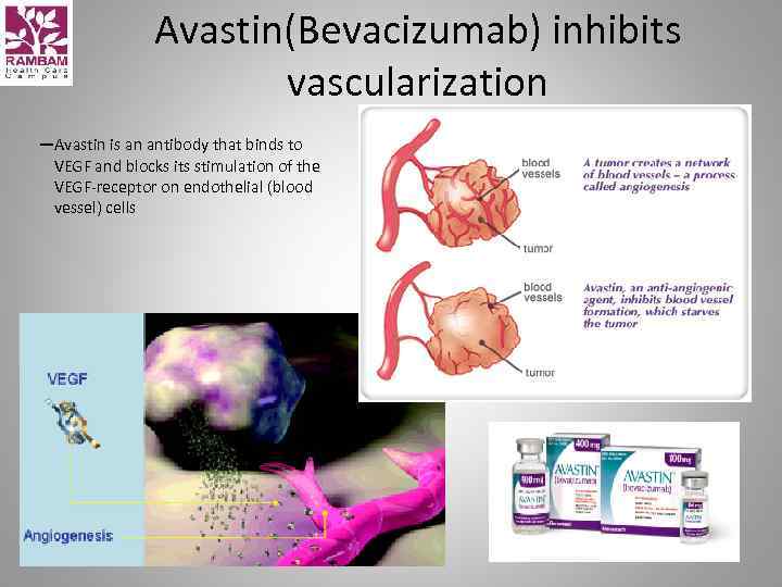 Avastin(Bevacizumab) inhibits vascularization —Avastin is an antibody that binds to VEGF and blocks its