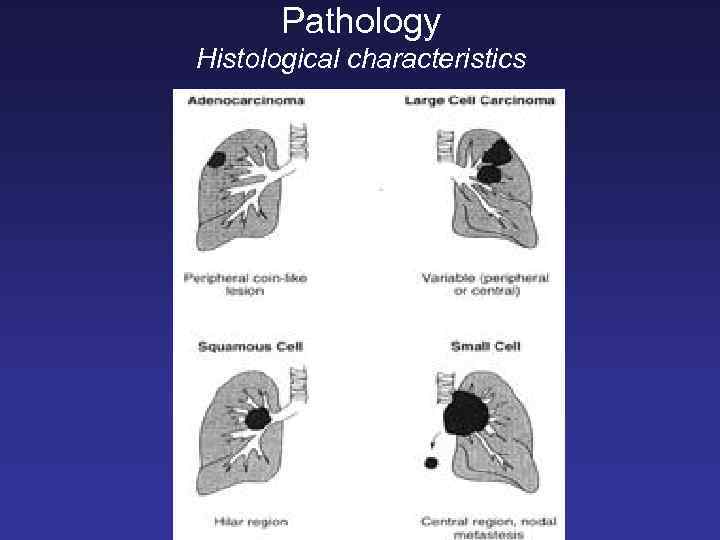 Pathology Histological characteristics 