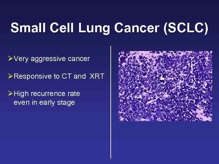 Small Cell Lung Cancer (SCLC) ØVery aggressive cancer ØResponsive to CT and XRT ØHigh