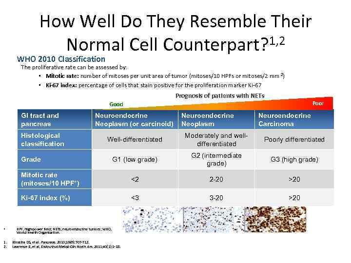 How Well Do They Resemble Their Normal Cell Counterpart? 1, 2 WHO 2010 Classification
