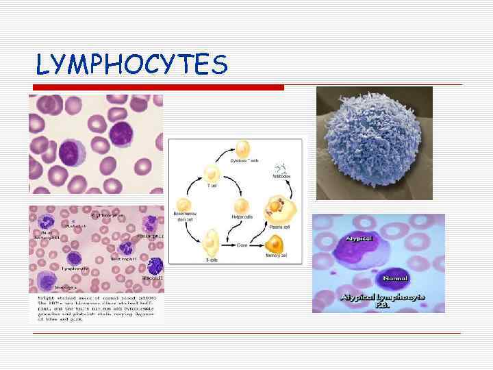 LYMPHOCYTES 