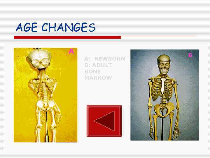 AGE CHANGES A A: NEWBORN B: ADULT BONE MARROW B 