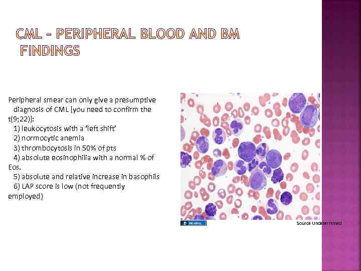 Peripheral smear can only give a presumptive diagnosis of CML [you need to confirm
