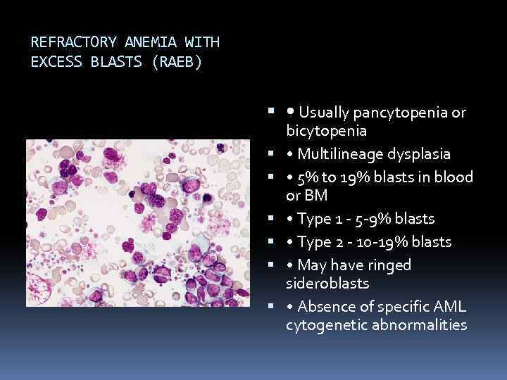 REFRACTORY ANEMIA WITH EXCESS BLASTS (RAEB) • Usually pancytopenia or bicytopenia • Multilineage dysplasia