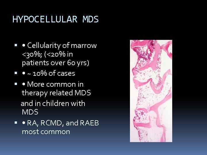 HYPOCELLULAR MDS • Cellularity of marrow <30%; (<20% in patients over 60 yrs) •