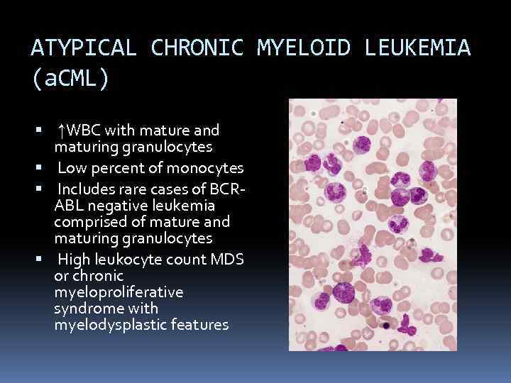 ATYPICAL CHRONIC MYELOID LEUKEMIA (a. CML) ↑WBC with mature and maturing granulocytes Low percent