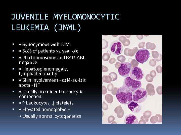 JUVENILE MYELOMONOCYTIC LEUKEMIA (JMML) • Synonymous with JCML • 60% of patients >2 year