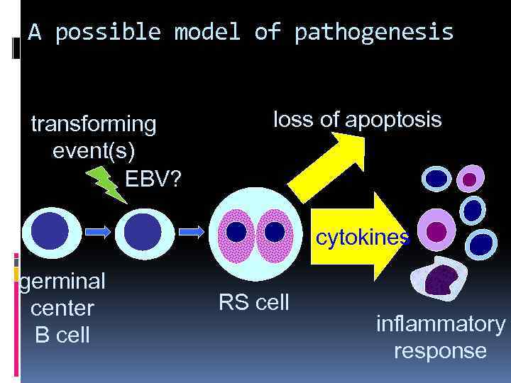 A possible model of pathogenesis transforming event(s) EBV? loss of apoptosis cytokines germinal center