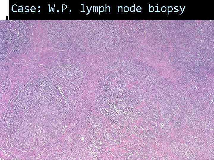 Case: W. P. lymph node biopsy 