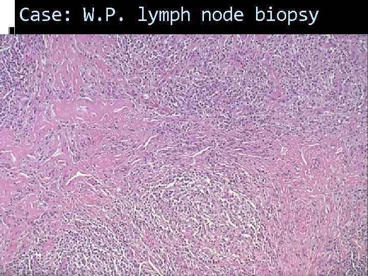 Case: W. P. lymph node biopsy 