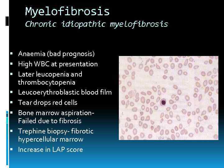 Myelofibrosis Chronic idiopathic myelofibrosis Anaemia (bad prognosis) High WBC at presentation Later leucopenia and