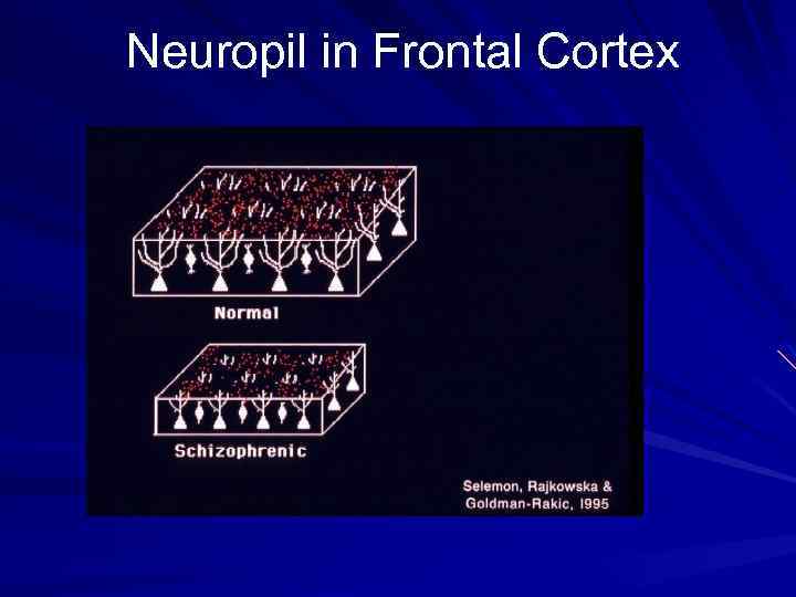 Neuropil in Frontal Cortex 