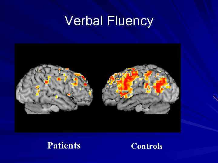 Verbal Fluency Patients Controls 