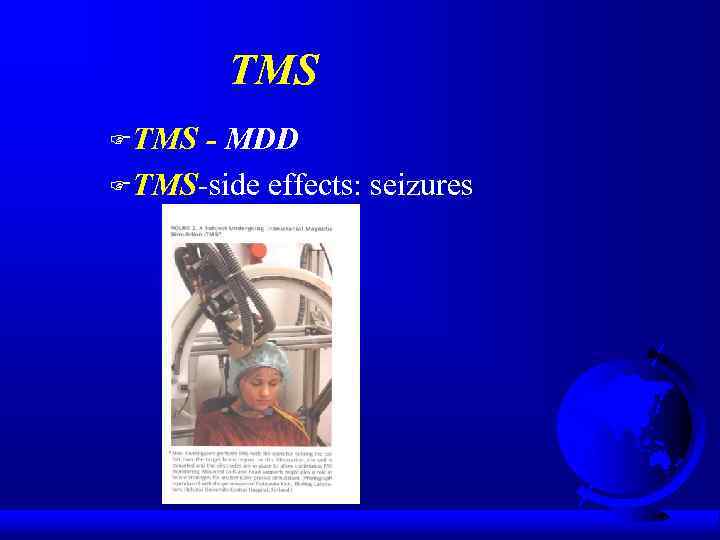 TMS FTMS - MDD FTMS-side effects: seizures 