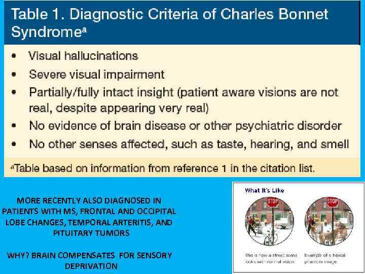 MORE RECENTLY ALSO DIAGNOSED IN PATIENTS WITH MS, FRONTAL AND OCCIPITAL LOBE CHANGES, TEMPORAL