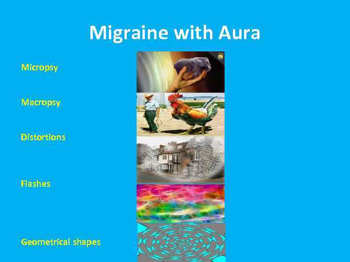Migraine with Aura Micropsy Macropsy Distortions Flashes Geometrical shapes 