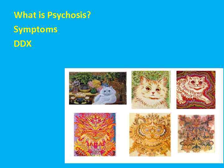 What is Psychosis? ההרצאה Symptoms DDX מבנה 