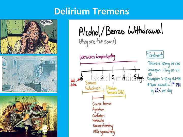 Delirium Tremens 