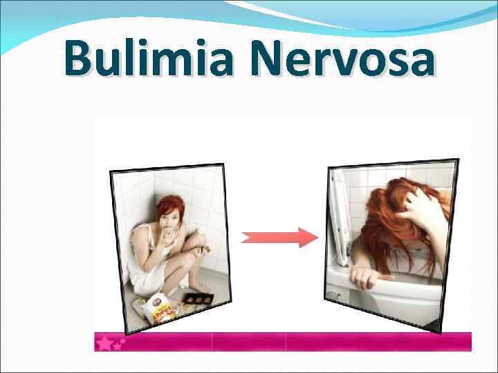 Bulimia Nervosa 