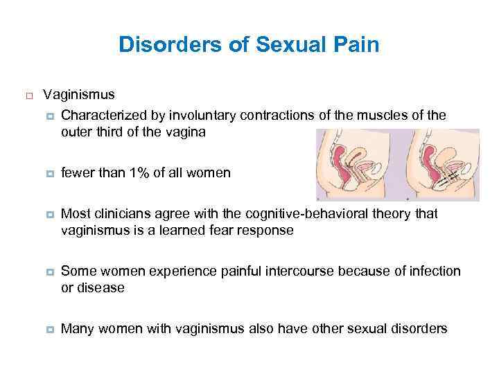 Disorders of Sexual Pain Vaginismus Characterized by involuntary contractions of the muscles of the