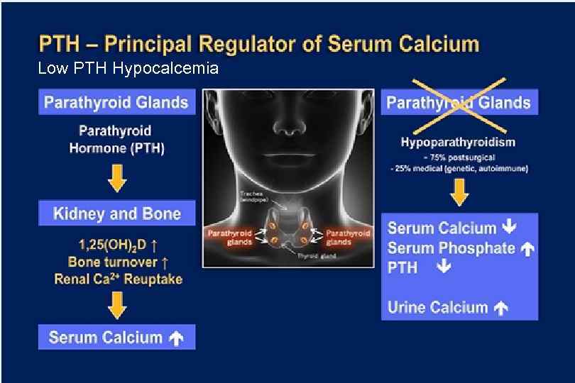 Low PTH Hypocalcemia 