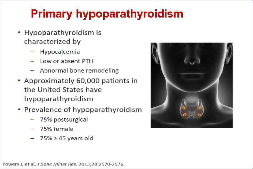 Primary hypoparathyroidism 