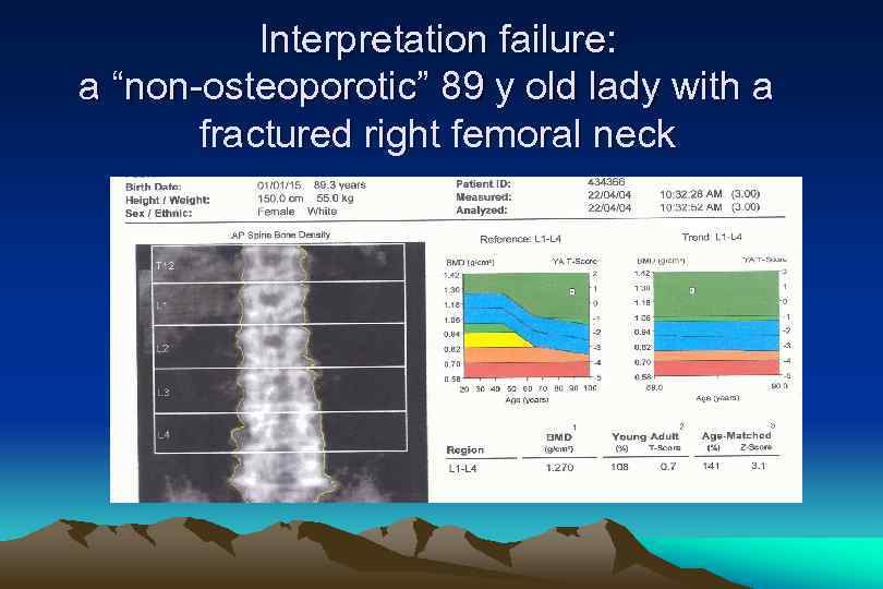 Interpretation failure: a “non-osteoporotic” 89 y old lady with a fractured right femoral neck