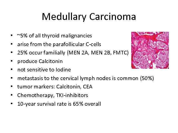 Medullary Carcinoma • • • ~5% of all thyroid malignancies arise from the parafollicular