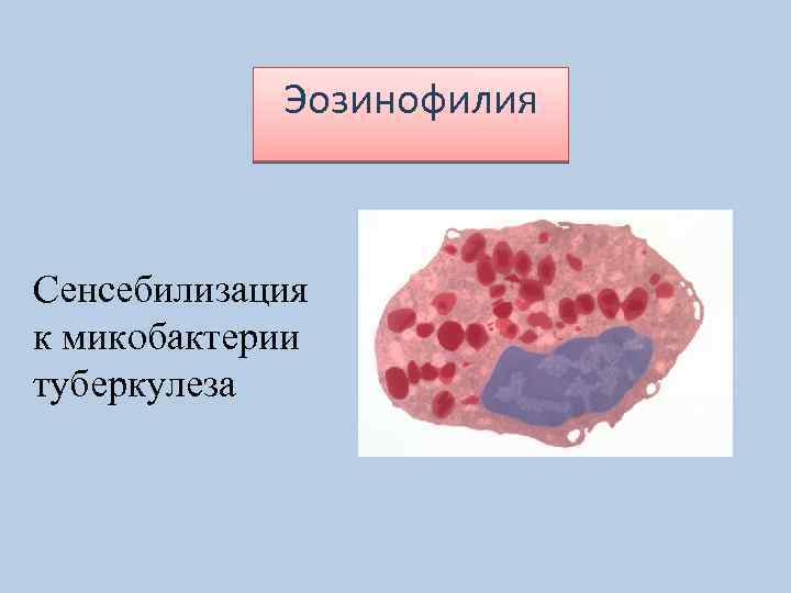 Эозинофилия Сенсебилизация к микобактерии туберкулеза 