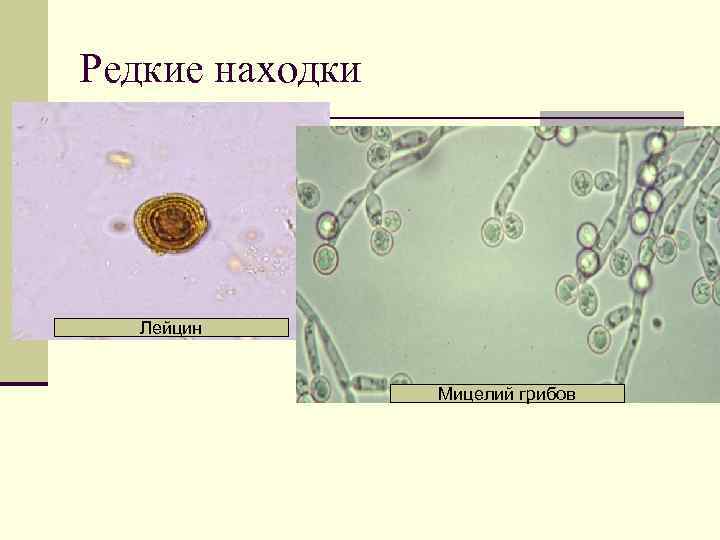 Редкие находки Лейцин Мицелий грибов 