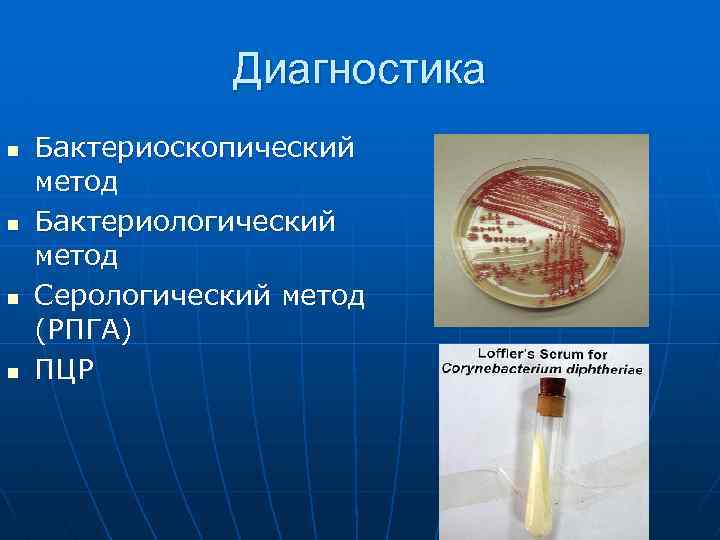 Диагностика n n Бактериоскопический метод Бактериологический метод Серологический метод (РПГА) ПЦР 
