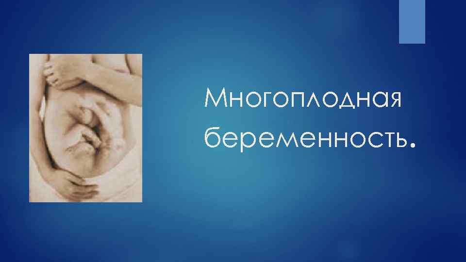 Многоплодная беременность презентация