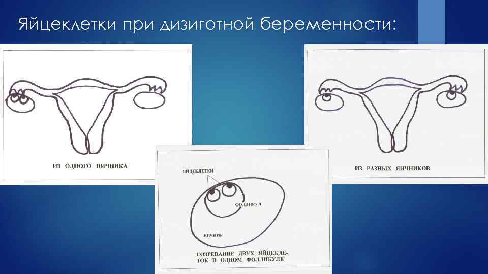 Яйцеклетки при дизиготной беременности: 