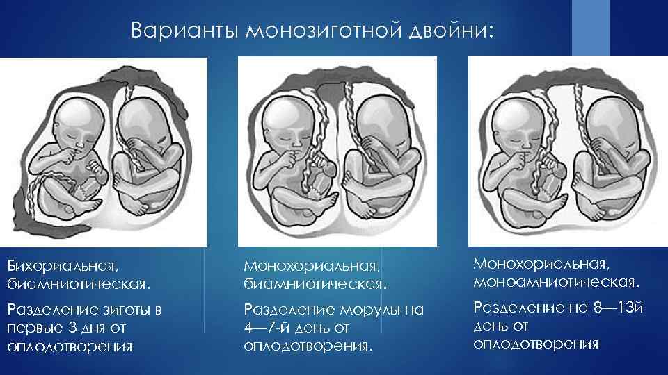 Многоплодная беременность по утвержденным клиническим рекомендациям. Монохориальная моноамниотическая многоплодная беременность. Монохориальная моноамниотическая двойня УЗИ 7 недель. Многоплодная беременность бихориальная. Монохориальная беременность двойней.