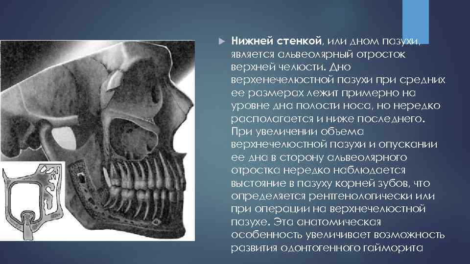 Стенки пазух. Стенки верхнечелюстной пазухи анатомия кт. Стенка пазухи верхнечелюстной анатомия стенки на кт. Верхняя стенка гайморовой пазухи. Верхнечелюстная пазуха рентген анатомия.