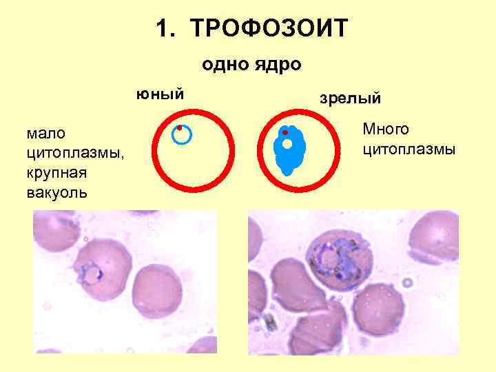 1. ТРОФОЗОИТ одно ядро юный мало цитоплазмы, крупная вакуоль зрелый Много цитоплазмы 