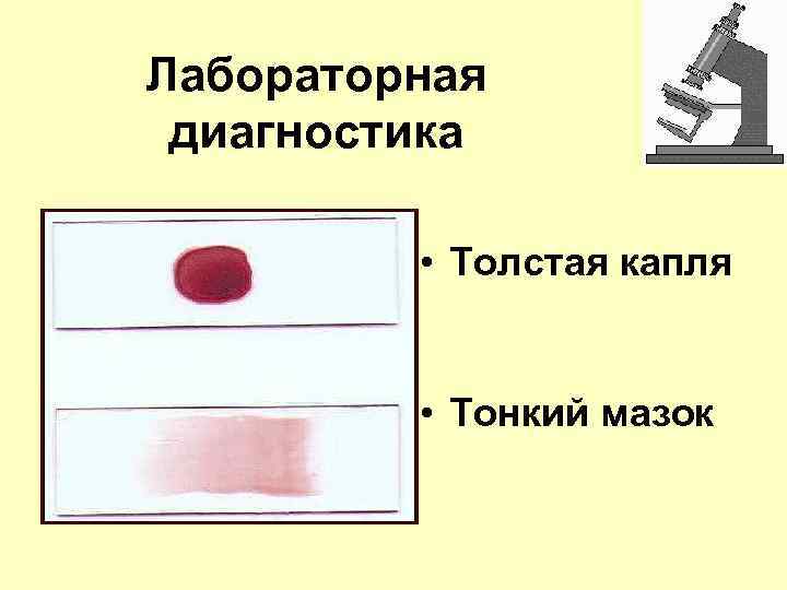 Лабораторная диагностика • Толстая капля • Тонкий мазок 