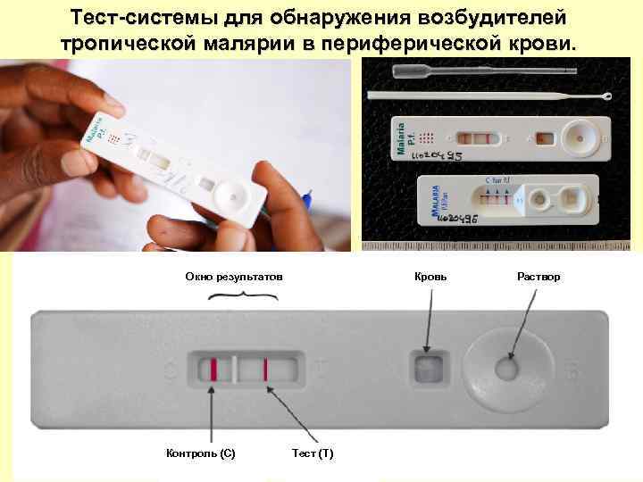 Тест-системы для обнаружения возбудителей тропической малярии в периферической крови. Окно результатов Контроль (С) Кровь