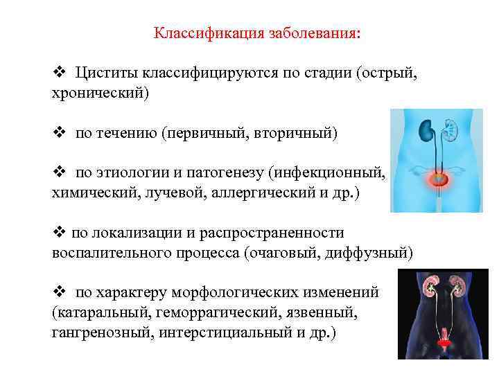 Классификация заболевания: v Циститы классифицируются по стадии (острый, хронический) v по течению (первичный, вторичный)