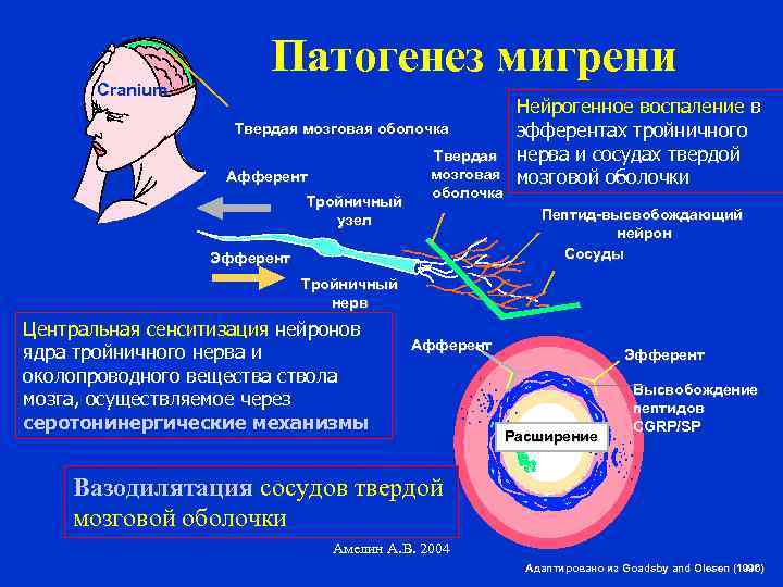 Cranium Патогенез мигрени Твердая мозговая оболочка Афферент Тройничный узел Твердая мозговая оболочка Нейрогенное воспаление