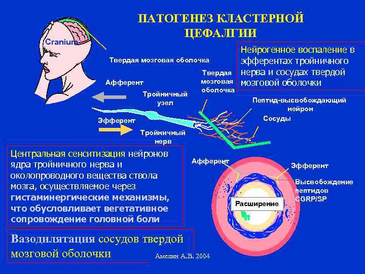 ПАТОГЕНЕЗ КЛАСТЕРНОЙ ЦЕФАЛГИИ Cranium Твердая мозговая оболочка Афферент Тройничный узел Твердая мозговая оболочка Нейрогенное